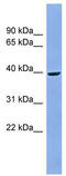Acid Phosphatase, Prostate antibody, TA346274, Origene, Western Blot image 