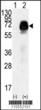 Anti-Mullerian Hormone Receptor Type 2 antibody, 62-667, ProSci, Western Blot image 