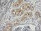 Integrin Alpha FG-GAP Repeat Containing 2 antibody, M17225-1, Boster Biological Technology, Immunohistochemistry paraffin image 
