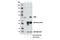 Transporter 2, ATP Binding Cassette Subfamily B Member antibody, 12259S, Cell Signaling Technology, Immunoprecipitation image 