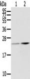 Retinol Binding Protein 4 antibody, TA350338, Origene, Western Blot image 