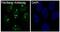 rRNA 2 -O-methyltransferase fibrillarin antibody, M03178, Boster Biological Technology, Immunofluorescence image 