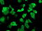 RNA-binding protein Musashi homolog 1 antibody, TA502311, Origene, Immunofluorescence image 