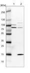 S1 RNA Binding Domain 1 antibody, NBP1-84630, Novus Biologicals, Western Blot image 