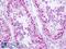 Ankyrin Repeat Domain 30A antibody, LS-B9148, Lifespan Biosciences, Immunohistochemistry paraffin image 