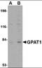 Glycerol-3-Phosphate Acyltransferase, Mitochondrial antibody, orb88417, Biorbyt, Western Blot image 