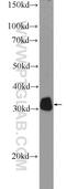 Prolyl 4-Hydroxylase Subunit Alpha 3 antibody, 23185-1-AP, Proteintech Group, Western Blot image 
