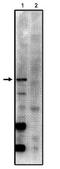 Protein Phosphatase 2 Regulatory Subunit B'Gamma antibody, AP05047PU-N, Origene, Western Blot image 