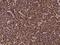 Zinc Finger Protein 195 antibody, 204720-T08, Sino Biological, Immunohistochemistry paraffin image 