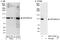 ERCC Excision Repair 4, Endonuclease Catalytic Subunit antibody, A301-315A, Bethyl Labs, Immunoprecipitation image 