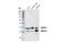 Protein Kinase AMP-Activated Non-Catalytic Subunit Beta 1 antibody, 4150S, Cell Signaling Technology, Western Blot image 