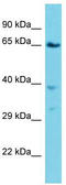 Vacuolar Protein Sorting 45 Homolog antibody, TA340171, Origene, Western Blot image 