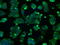 Hydroxysteroid 17-Beta Dehydrogenase 10 antibody, GTX84347, GeneTex, Immunofluorescence image 