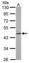 Mitochondrial Elongation Factor 2 antibody, PA5-31709, Invitrogen Antibodies, Western Blot image 