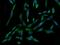Fatty acid-binding protein, intestinal antibody, GTX02403, GeneTex, Immunofluorescence image 