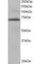 Ran GTPase Activating Protein 1 antibody, orb18635, Biorbyt, Immunohistochemistry paraffin image 