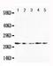 Fibroblast growth factor 10 antibody, PA1454, Boster Biological Technology, Western Blot image 