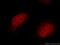 Synaptonemal Complex Central Element Protein 1 antibody, 11063-1-AP, Proteintech Group, Immunofluorescence image 