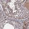 Sperm surface protein Sp17 antibody, FNab08136, FineTest, Immunohistochemistry frozen image 