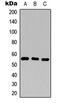 CD25 antibody, abx121575, Abbexa, Western Blot image 