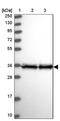 Eukaryotic Translation Elongation Factor 1 Delta antibody, NBP1-91861, Novus Biologicals, Western Blot image 