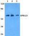 Adhesion G Protein-Coupled Receptor A1 antibody, A14766, Boster Biological Technology, Western Blot image 