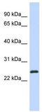 Krueppel-like factor 16 antibody, TA329103, Origene, Western Blot image 