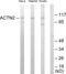 Actinin Alpha 2 antibody, PA5-38605, Invitrogen Antibodies, Western Blot image 