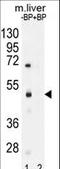 Sterile Alpha Motif Domain Containing 8 antibody, LS-C162859, Lifespan Biosciences, Western Blot image 