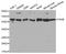 Prolyl 4-Hydroxylase Subunit Beta antibody, TA326851, Origene, Western Blot image 
