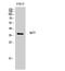 Immunoglobulin Heavy Constant Gamma 1 (G1m Marker) antibody, STJ93658, St John