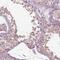 Rho Family GTPase 2 antibody, NBP2-69052, Novus Biologicals, Immunohistochemistry paraffin image 