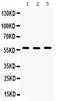 Chaperonin Containing TCP1 Subunit 2 antibody, PB9992, Boster Biological Technology, Western Blot image 
