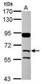 Complement Factor H Related 5 antibody, GTX109982, GeneTex, Western Blot image 