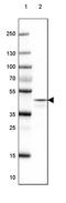 N-Terminal EF-Hand Calcium Binding Protein 1 antibody, PA5-54849, Invitrogen Antibodies, Western Blot image 