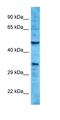 Keratinocyte-associated protein 2 antibody, orb327018, Biorbyt, Western Blot image 