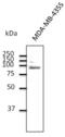 Toll Like Receptor 2 antibody, LS-C204256, Lifespan Biosciences, Western Blot image 