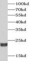 Recoverin antibody, FNab07225, FineTest, Western Blot image 