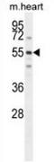 Spermatogenesis And Centriole Associated 1 antibody, AP54004PU-N, Origene, Western Blot image 