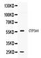 Cytochrome P450 Family 3 Subfamily A Member 4 antibody, PB10055, Boster Biological Technology, Western Blot image 
