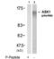 Mitogen-Activated Protein Kinase Kinase Kinase 5 antibody, GTX79137, GeneTex, Western Blot image 