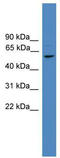 F-Box And Leucine Rich Repeat Protein 16 antibody, TA337838, Origene, Western Blot image 