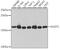 Nudix Hydrolase 1 antibody, A13330, ABclonal Technology, Western Blot image 