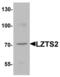 Leucine Zipper Tumor Suppressor 2 antibody, LS-B9591, Lifespan Biosciences, Western Blot image 
