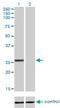 BCAS2 Pre-MRNA Processing Factor antibody, H00010286-M01, Novus Biologicals, Western Blot image 