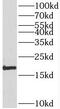 Sorting nexin-3 antibody, FNab08091, FineTest, Western Blot image 