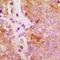 FES Proto-Oncogene, Tyrosine Kinase antibody, orb318770, Biorbyt, Immunohistochemistry paraffin image 
