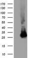 Glutathione S-Transferase Theta 2 (Gene/Pseudogene) antibody, TA501830, Origene, Western Blot image 
