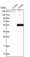 3-Oxoacyl-ACP Synthase, Mitochondrial antibody, NBP1-84730, Novus Biologicals, Western Blot image 