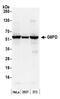 Glucose-6-phosphate 1-dehydrogenase antibody, A300-404A, Bethyl Labs, Western Blot image 